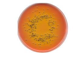 Agar Ss Salmonella Shigella  90 X 15 -10 Unid - Laborclin