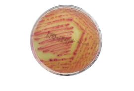 Agar Cromogênico Esbl 90 X 15 Mm - 10 Placas - Laborclin