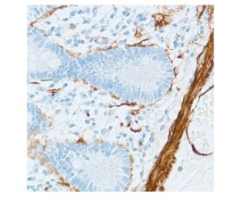 Alpha-1-Fetoproteina (AFP), Clone Ep209 Pronto Para Uso - 6 Ml - Easypath - EP-12-50083