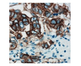 C-ERBB-2/HER2/NEU Monoclonal De Coelho Clone (SP3) Pronto Para Uso - 6 Ml - Easypath - EP-12-50936