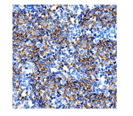 CD23 Clone SP23 Pronto Para Uso - 6 Ml - Easypath - EP-12-50566