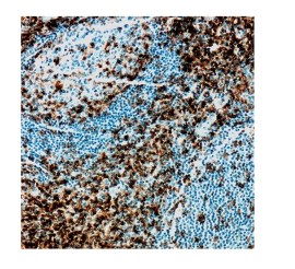 CD4 Clone EP204 Pronto Para Uso - 6 Ml - Easypath - EP-12-50676