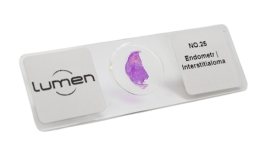 Lamina Ascaris Lumbricoides ,Verme Adulto Femea S.T. - Lm-445 - Lumen