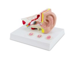 Ouvido Com Patologia Ampliado 1,5 Vezes - Ou12