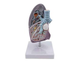 Pulmao Com Patologia - Pu12