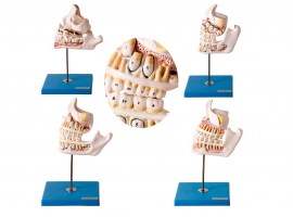 Desenvolvimento Da Dentição Em 4 Peças - TZJ-0313-D